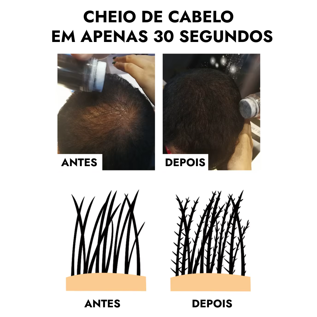 Sevich Fibras de Queratina - Solução Definitiva para Calvicie